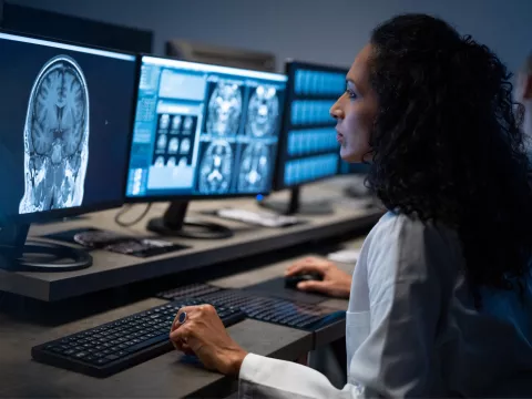 Doctor looking at a brain CT scan.