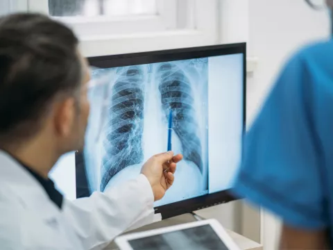 A doctor pointing at a lung in a chest CT scan with a nurse next to him.