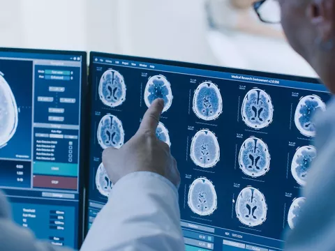 Doctors looking at a screen with brain scans