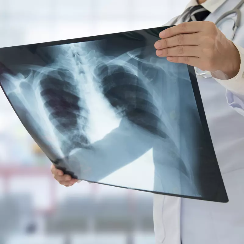 Physician viewing an x-ray of a patient's chest