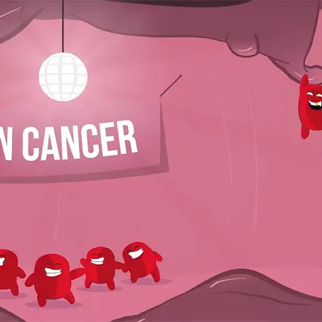 Colon Cancer video Thumbnail
